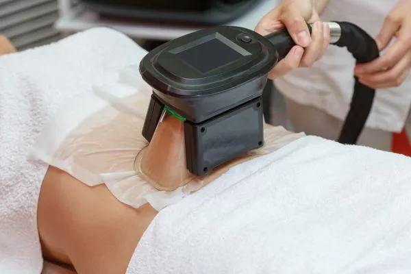 Image of person having fat freezing treatment to help weight gain York