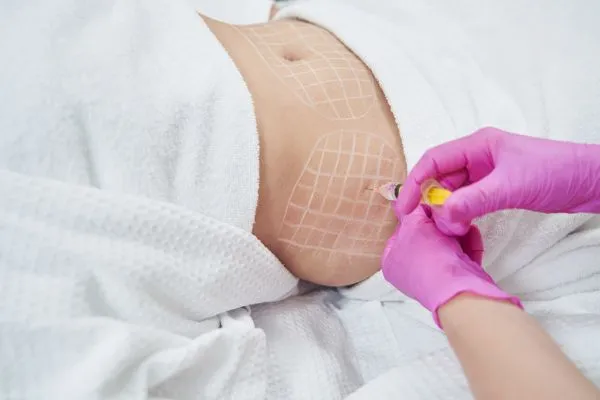 image of fat dissolving injections on love handles to help combat weight gain York