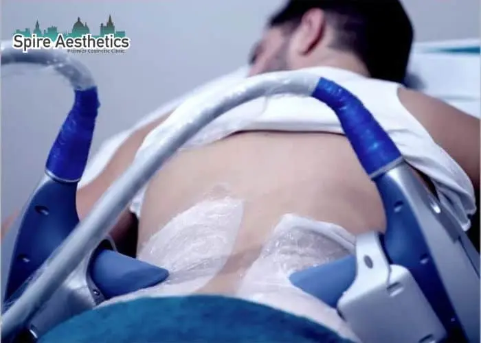 Man having fat freezing treatment done on love handles before a competitions York to create a sculpted look.