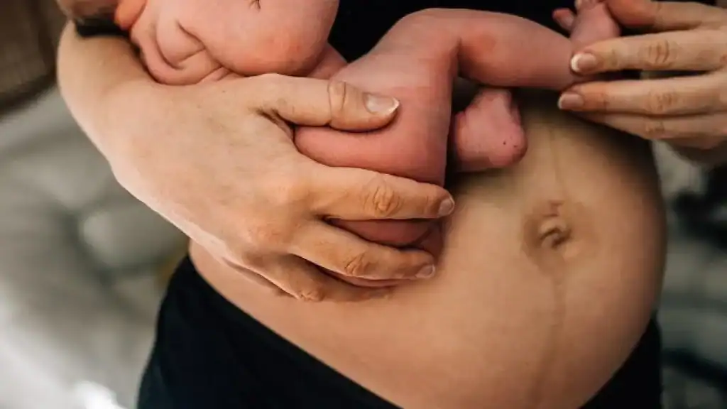 Why Is My Stomach Still Big After Pregnancy York?