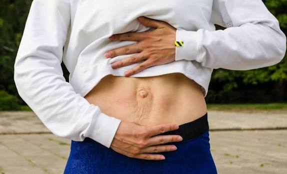 When Could Diastasis Recti Be the Missing Piece of the Puzzle York?